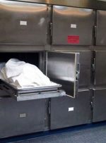 آنژیوگرافی به قیمت جان دختر ۱۷ ساله تمام شد!